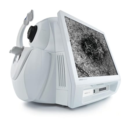 Zeiss OCT (Optical Coherence Tomography)